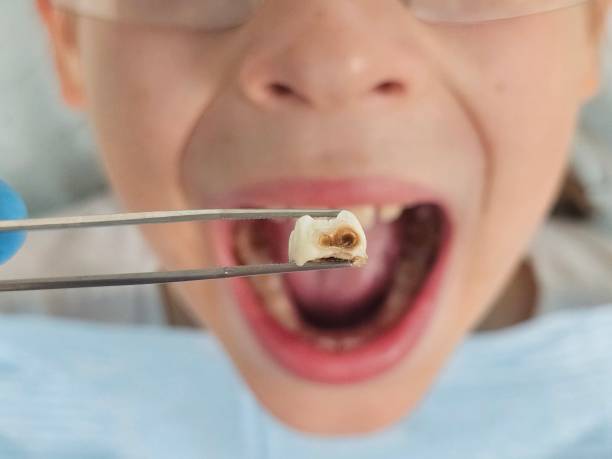 Best Walk-In Emergency Dentist in Pleasant View, TN